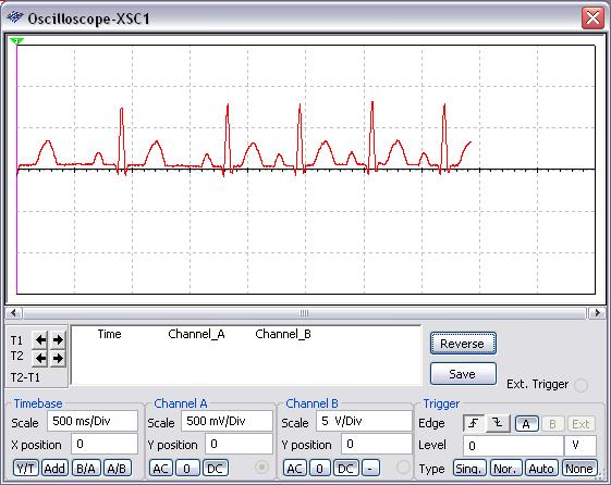 Run the simulation and view the change in the ECG signal in the oscilloscope.