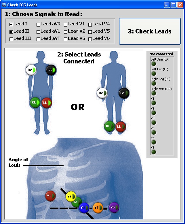 Electrocardiography (ECG) Starter Kit Application Software - National ...