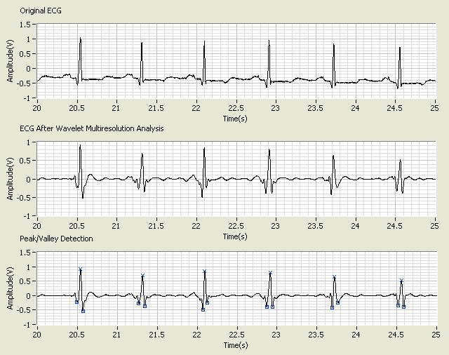 Ecg analysis. Электрокардиограмма это аналоговым сигналом. Фонокардиограф. Сигнал ЭКГ гармоники. Фонокардиография методика.